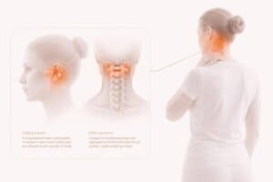 Illustration av KISS- och KIDD-syndrom med symtom i nacke och huvud.